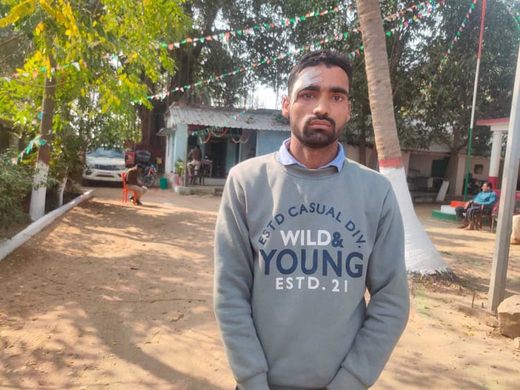 शंभुगंज में युवक को मारपीट कर किया जख्मी, थाना में की शिकायत