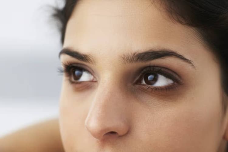 आंखों के नीचे काले घेरे क्यों पड़ते हैं? आयुर्वेद एक्सपर्ट से जानें कारण और घरेलू उपाय