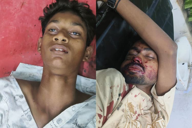 अमौर में स्टेट हाईवे-99 पर दो बाइकों की आमने-सामने भीषण भिड़ंत; दो युवक गंभीर रूप से घायल, पूर्णिया रेफर