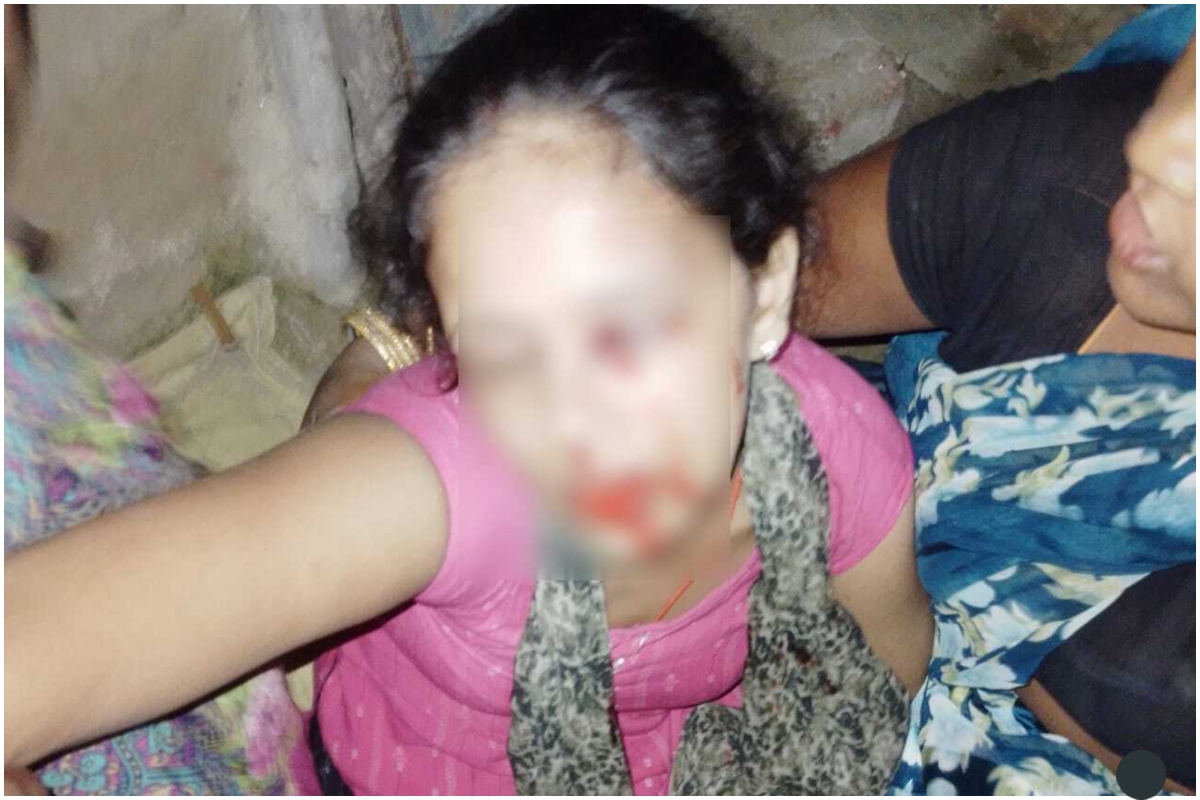 मोतिहारी: दहेज के लिए पत्नी की आंख फोड़ने का आरोप, पति गिरफ्तार