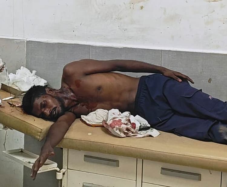रोड रेज में युवक पर जानलेवा हमला, ब्लेड व पंजे से किया लहूलुहान
