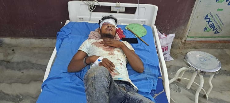 धेनुकट्टा मोड़ पर बाइक की सीधी टक्कर, दो युवक घायल