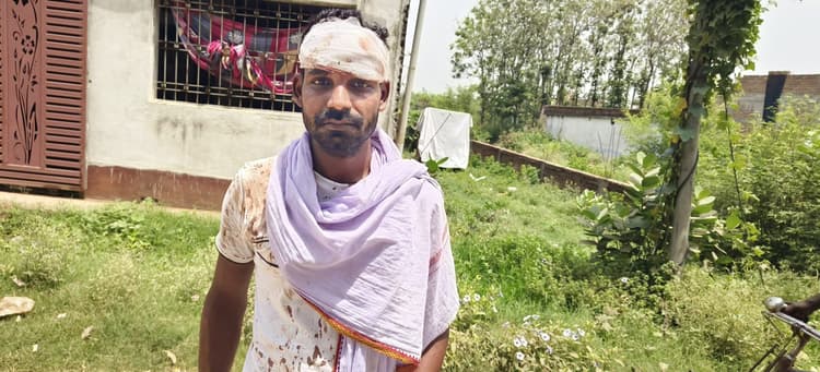 पति व पत्नी के विवाद में हुई मारपीट कांड में पति हुआ घायल