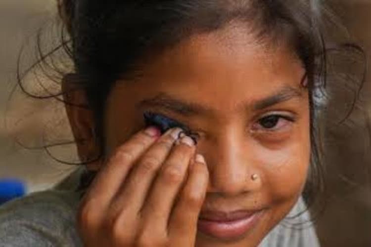 कोशी क्षेत्र में तेजी से फैल रहा आई फ्लू, सहरसा-सुपौल-मधेपुरा में बढ़े मरीज, डॉक्टरों ने जारी की चेतावनी