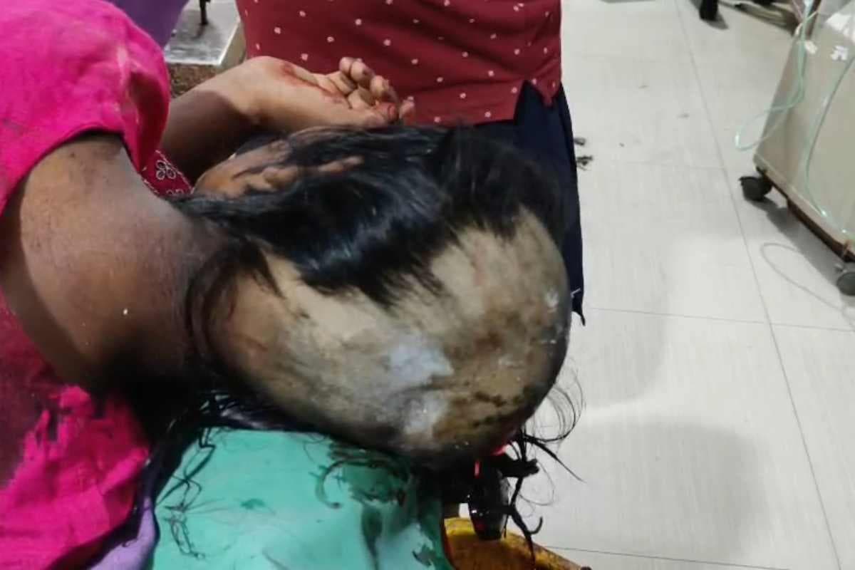 Samastipur Panchayat Cruelty: तालिबानी सजा– प्रेम प्रसंग में नाबालिग चचेरे भाई-बहन का सिर मुंडवाया, कालिख पोत गांव से निकाला