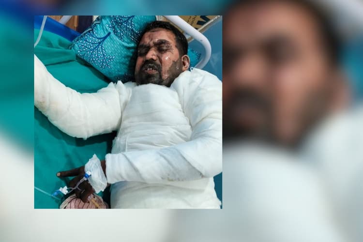 'सीवान पेट्रोल कांड' में झुलसा युवक 19 दिन तक मौत से लड़ता रहा, गोरखपुर अस्पताल में आखिर जिंदगी की जंग हार गया