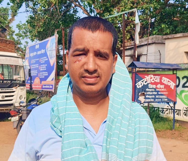 शिक्षक दंपति पर फायरिंग और मारपीट, नकदी व आभूषण छीने