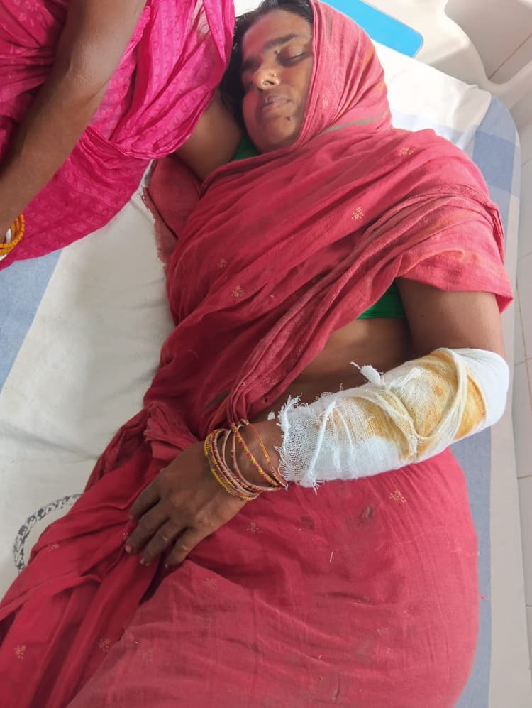 खेत में घास काटने गई महिला पर हमला, जख्मी