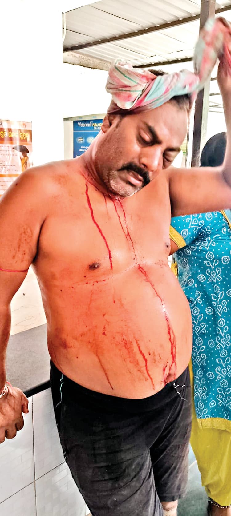 Rourkela News: मालगोदाम बस्ती में जमीन विवाद को लेकर दो परिवारों में मारपीट, एक व्यक्ति घायल