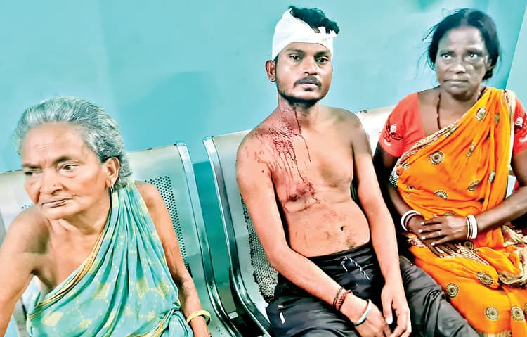 Dhanbad News : आठ बेटों की मां को खाने के लाले, मारपीट में देवर-भाभी घायल
