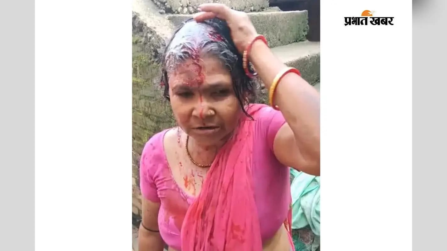 जख्मी महिला जख्मी महिला