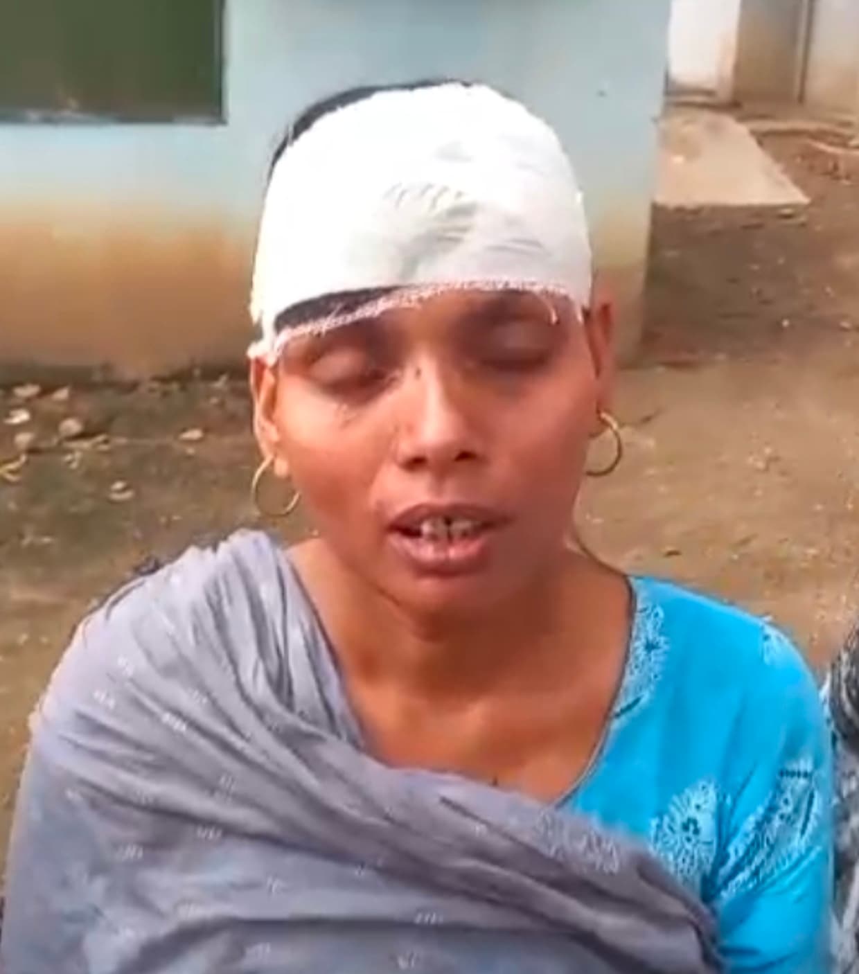 यात्रियों से भरा टैंपो पलटा, महिला बच्चा सहित आधा दर्जन यात्री घायल यात्रियों से भरा टैंपो पलटा, महिला बच्चा सहित आधा दर्जन यात्री घायल