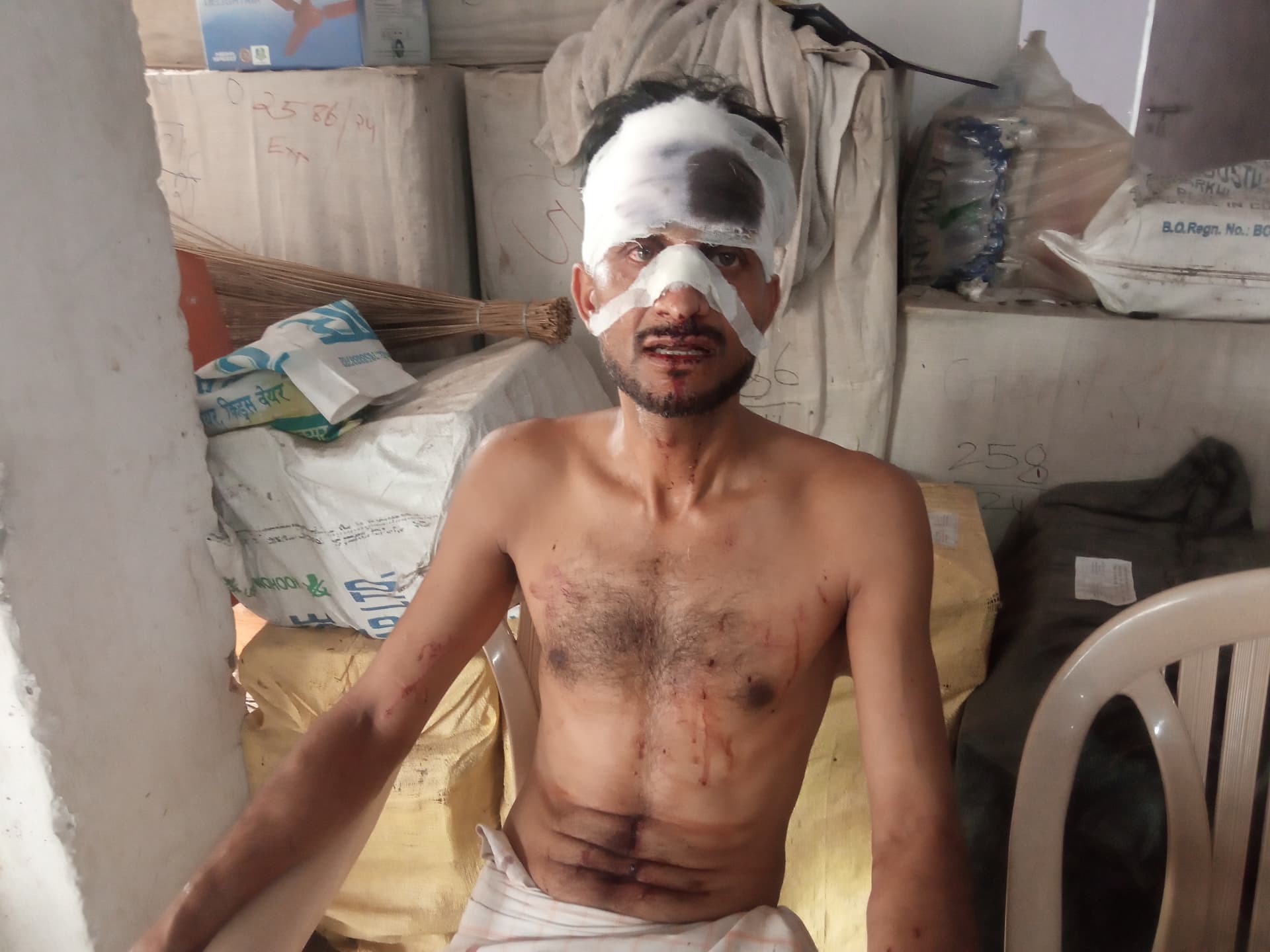 बक्सर में खून के रिश्ते हुए तार-तार, बड़े ने छोटे भाई के सिर पर डंडे-रॉड से किया घातक प्रहार बक्सर में खून के रिश्ते हुए तार-तार, बड़े ने छोटे भाई के सिर पर डंडे-रॉड से किया घातक प्रहार