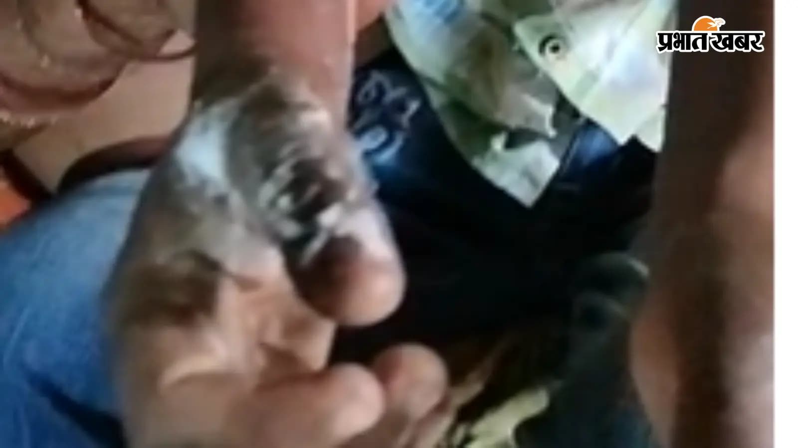 छह वर्षीय बालक का झुलसा हुआ हाथ छह वर्षीय बालक का झुलसा हुआ हाथ