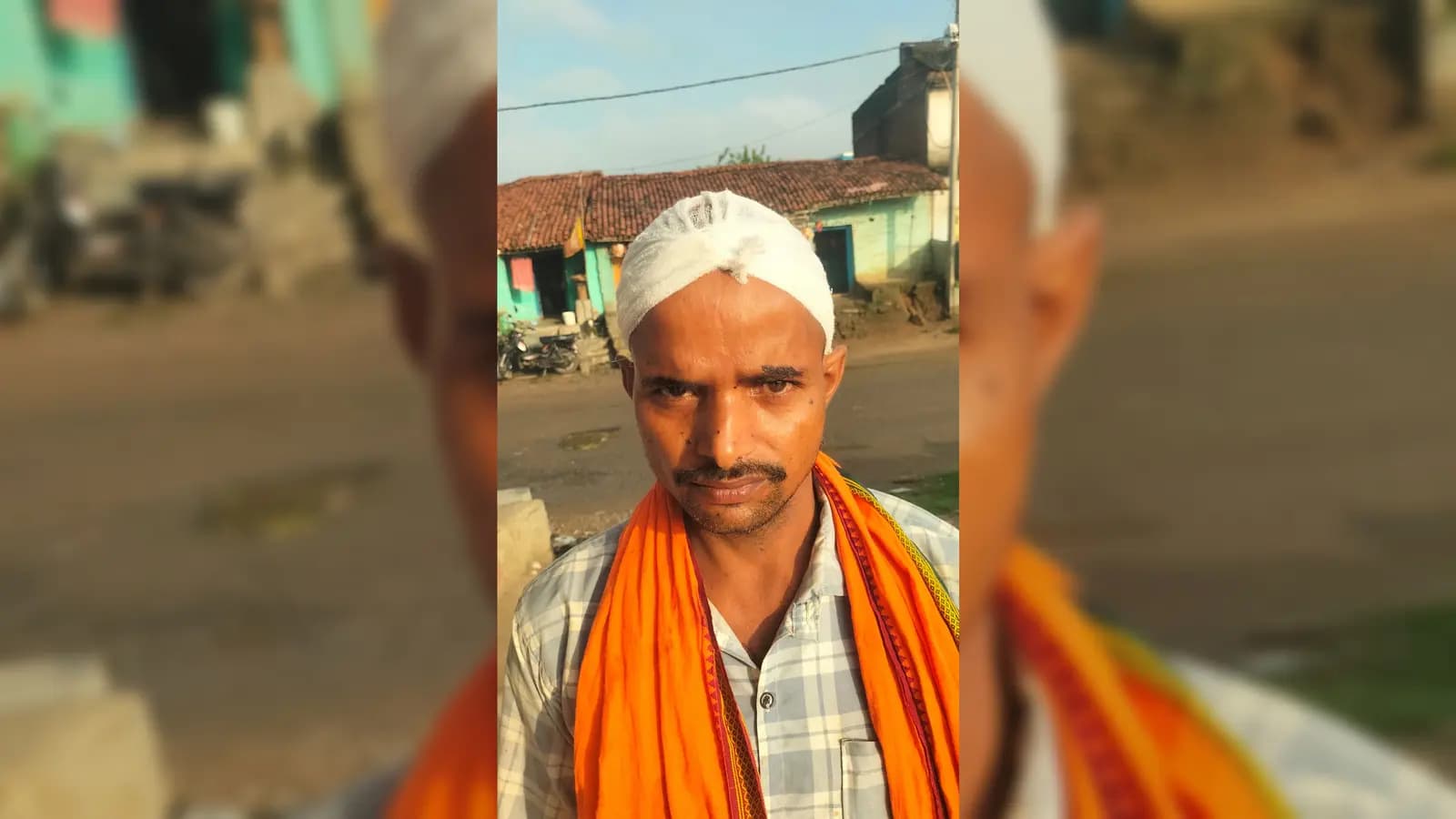 सारठ में दो सगे भाई के बीच मारपीट, एक भाई गंभीर रूप से घायल