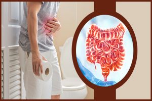 Ayurvedic Remedies for Constipation