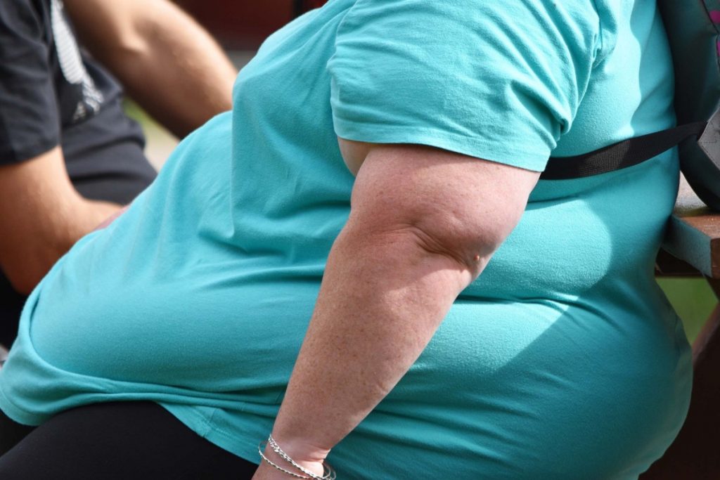 8 Reasons For Obesity Problem: इन 8 कारणों से होती हैं मोटापे की समस्या 2 Obesity 1