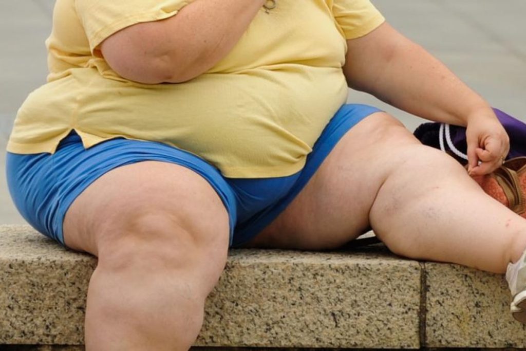 8 Reasons For Obesity Problem: इन 8 कारणों से होती हैं मोटापे की समस्या 5 Obesity 6 1