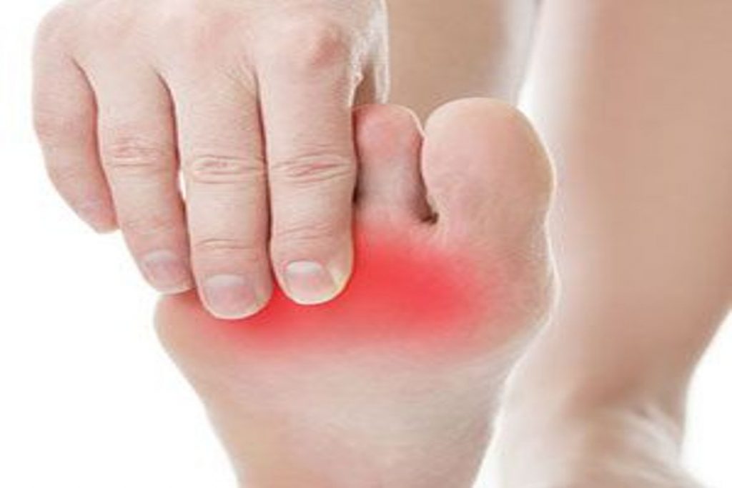Burning Sensation In Feet: पैरों में बनी रहती है जलन तो ना करें नजरअंदाज, इन बीमारियों के हैं संकेत 4 Sugar In Feet
