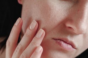 Dry Skin Tips