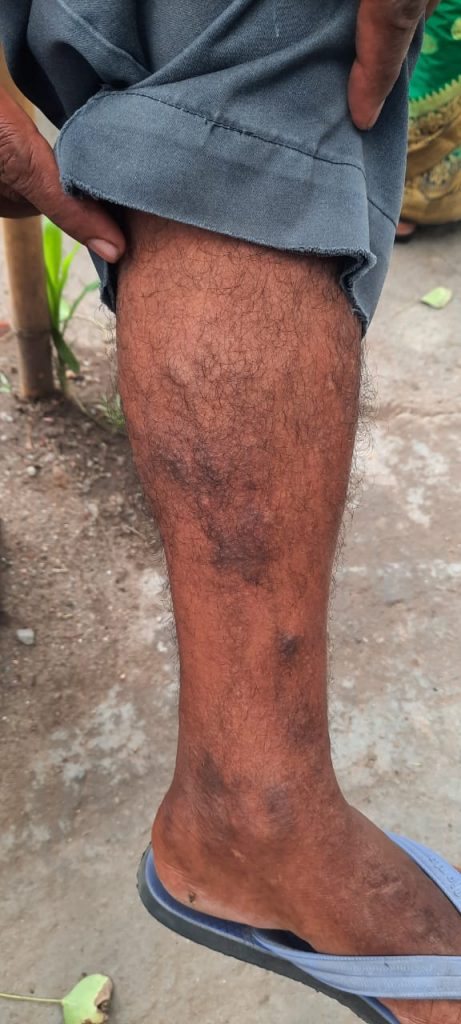 सुंदरनगर पुलिस के एसआई ने ठेला संचालक को पिटा,बर्बाद करने की दी धमकी,कार्रवाई की मांग को लेकर जिप अध्यक्ष ने किया सड़क जाम 2 33