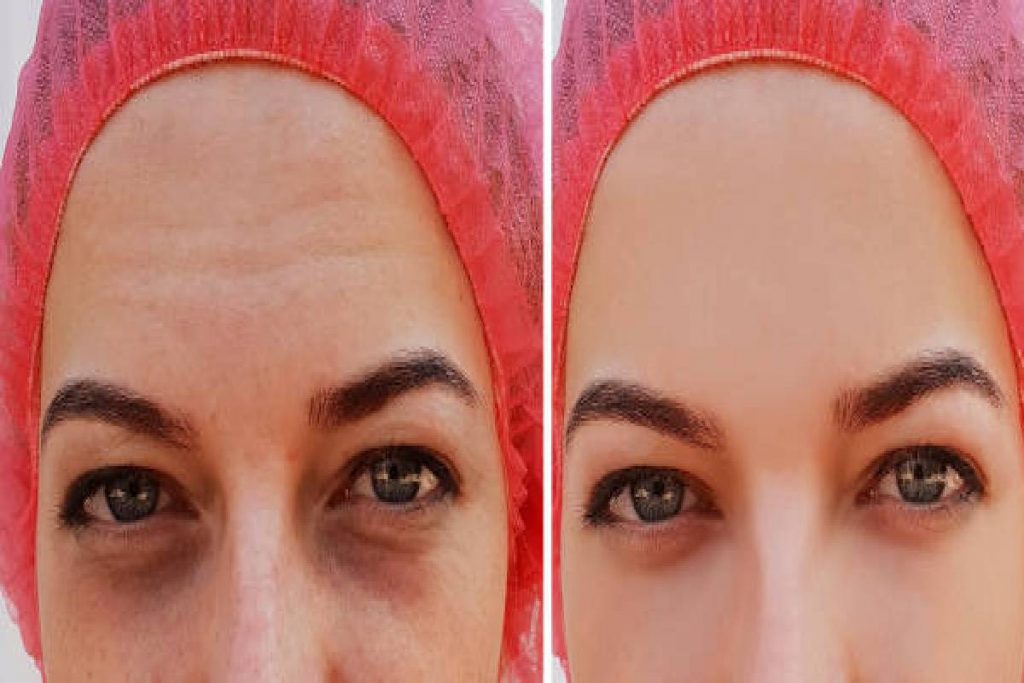 Dark Circles से कम हो गई है खूबसूरती, आजमाएं ये घरेलू उपाय 1 New Project 2024 10 18T093102.701