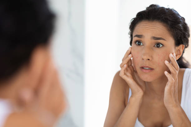 Skin Care Tips: मखाने के सेवन से चेहरे को मिलते हैं ये चमत्कारी फायदे 3 Istockphoto 1384900119 612X612 1