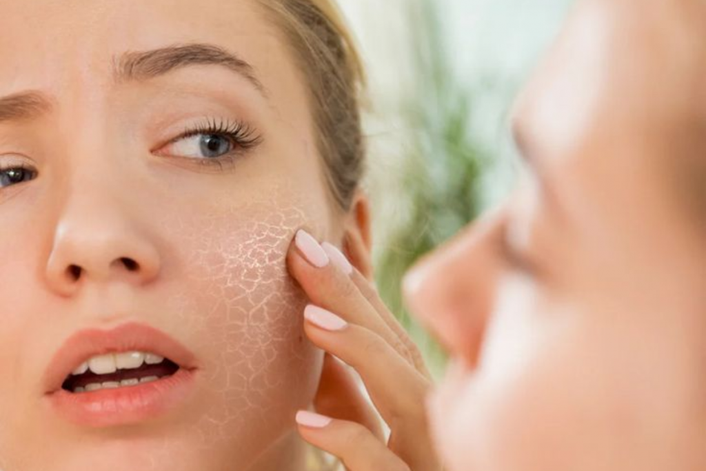 Home Made Lotion For Dry Skin: लोशन लगाने के बाद भी हो रही है स्किन ड्राइ, तो मोम और नारियल तेल से बनाएं ये लोशन 1 Tips For Dry Skin Care In Winters: सर्दी में रुखेपन के कारण हो रही है असुविधा तो अपनाएं ये टिप्स